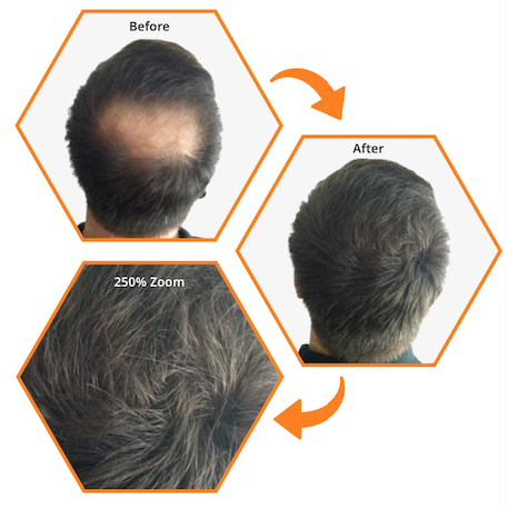 How to Choose the Right Hair Fiber for Your Hair Type
