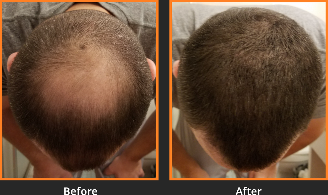 Hair Fibers Before and After: See the Difference in Just 60 Seconds