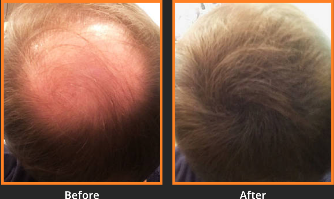 The Best Way to Apply Hair Fibers for a Natural Look