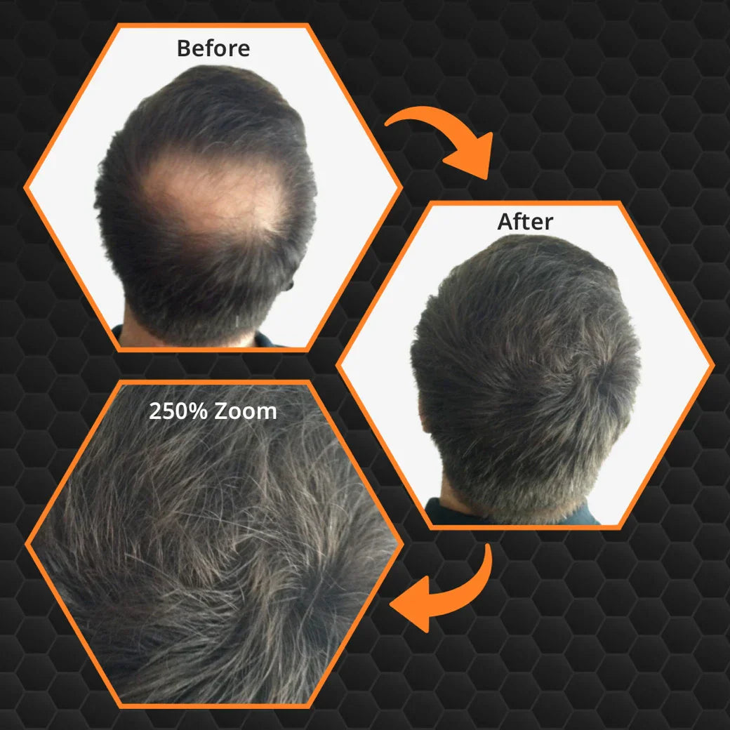 How Hair Fibers Can Transform Your Confidence